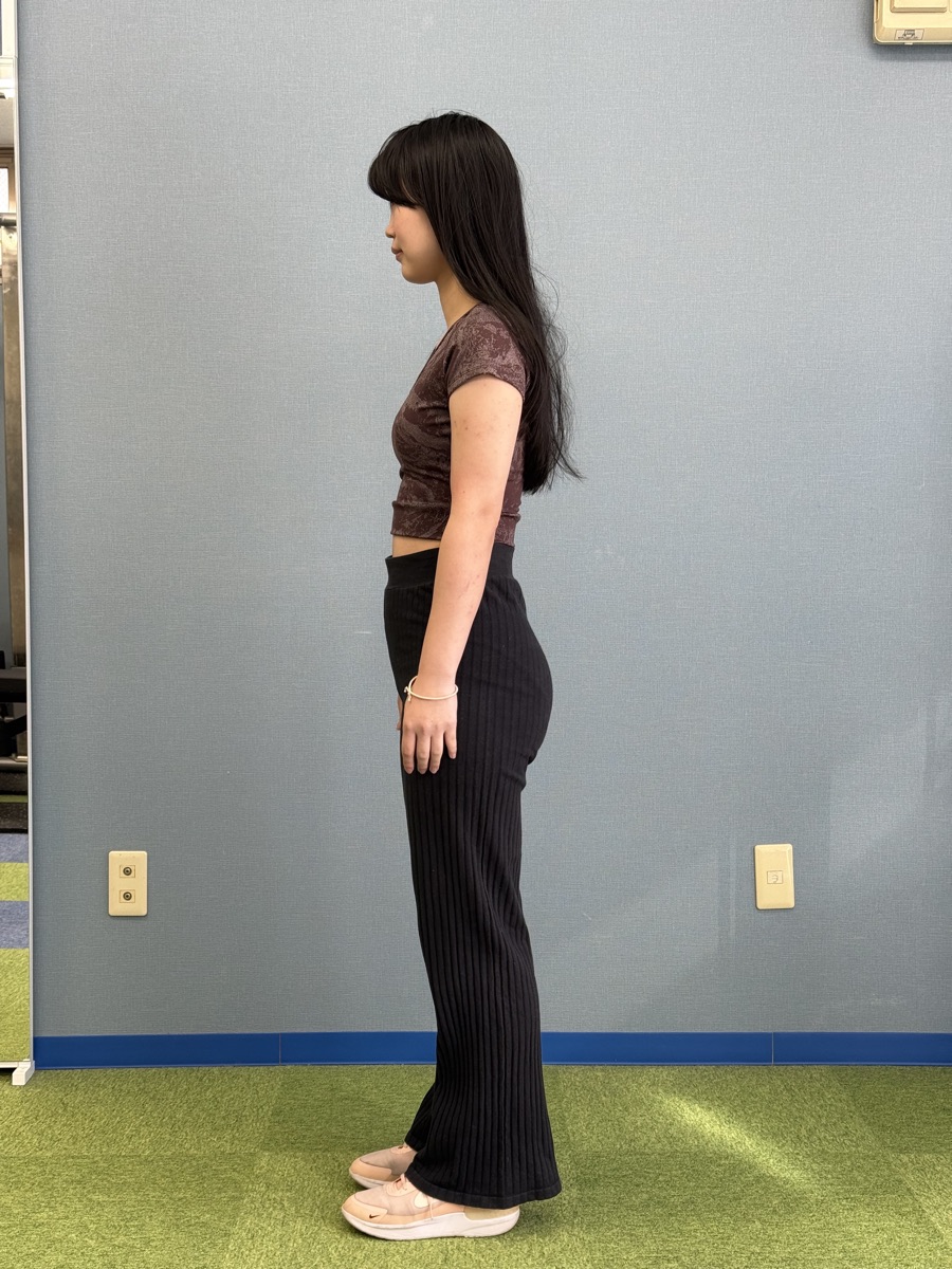 25歳女性 Before
